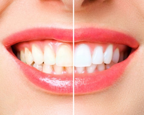 cosmetic dentistry