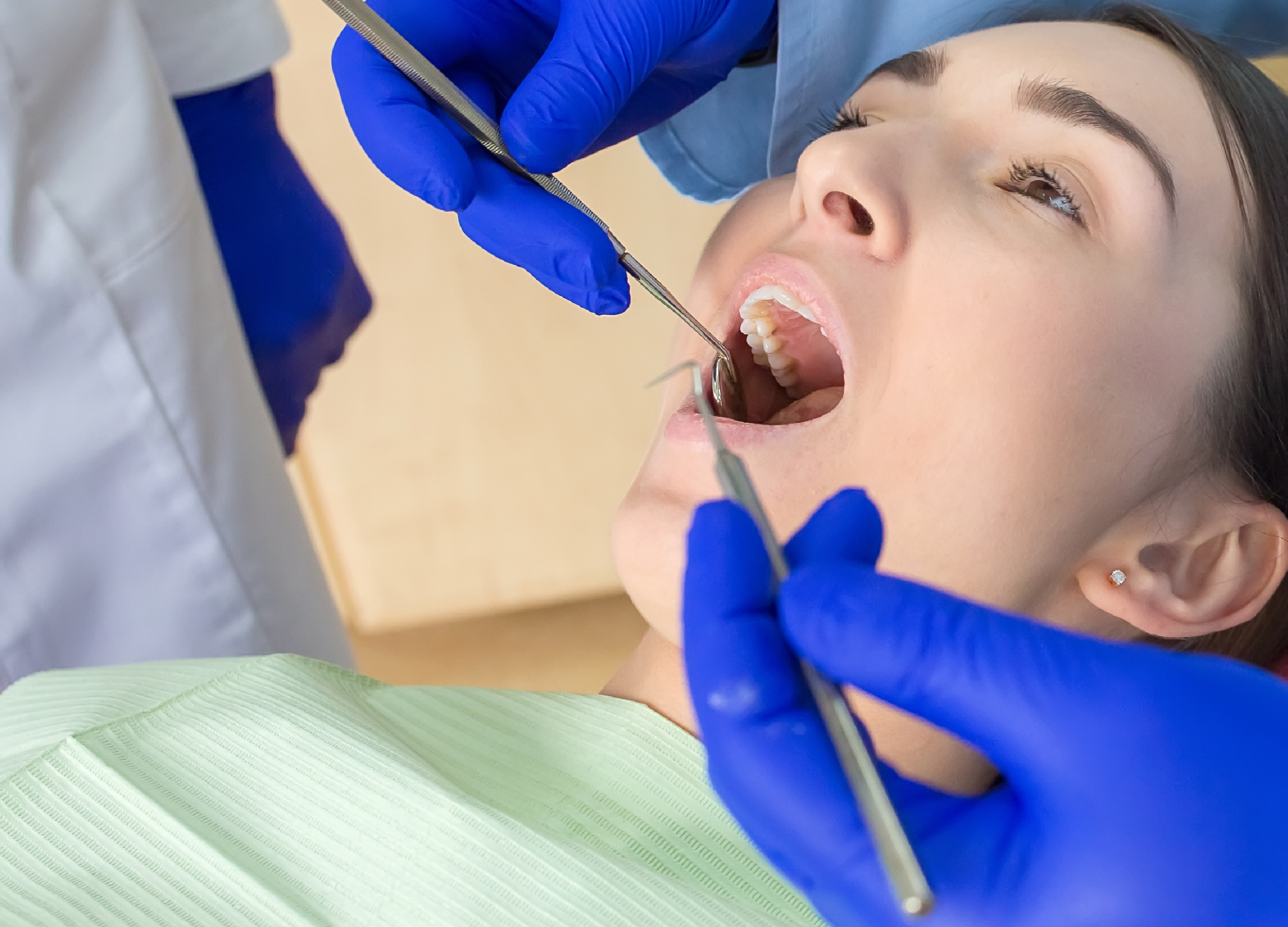 tooth extraction Marion Oaks